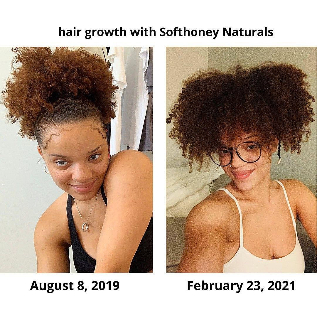 Glory Hair Growth Oil